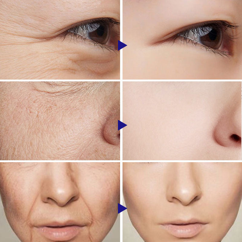GlowVital™ 20% Vitamin C + Hyaluronic Acid Serum